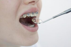 矯正の検査を受けている様子