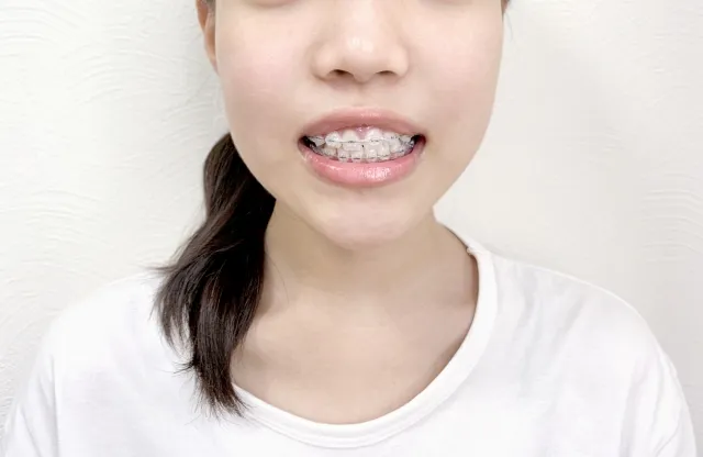 成人矯正